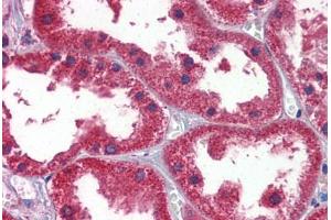 Human Kidney: Formalin-Fixed, Paraffin-Embedded (FFPE) (DDAH1 antibody  (AA 108-157))