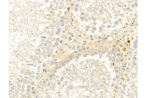 ABIN6261163 and ABIN6273037 at 1/100 staining Rat testis tissue by IHC-P.