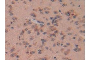 DAB staining on IHC-P; Samples: Mouse Brain Tissue (Pituitary Adenylate Cyclase Activating Peptide (AA 1-175) antibody)