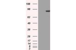 Image no. 5 for anti-Signal Transducer and Activator of Transcription 1, 91kDa (STAT1) antibody (ABIN1501169)