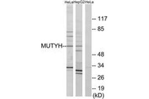 Western blot analysis of extracts from HeLa/HepG2 cells, using MUTYH Antibody. (MUTYH antibody  (AA 151-200))