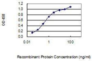 Detection limit for recombinant GST tagged JARID1D is 0. (KDM5D antibody  (AA 127-230))