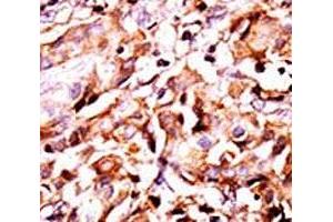 Immunohistochemistry (IHC) image for anti-BCL2-Associated Agonist of Cell Death (BAD) (pSer99) antibody (ABIN3030130)