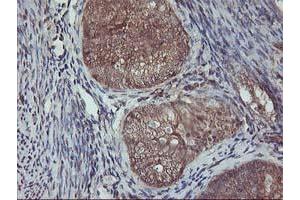 Image no. 1 for anti-V-Akt Murine Thymoma Viral Oncogene Homolog 1 (AKT1) antibody (ABIN1496554) (AKT1 antibody)
