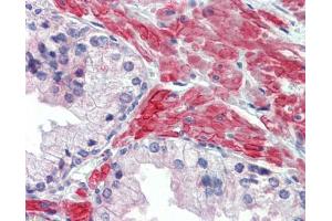 IHC-P Image Immunohistochemical analysis of paraffin-embedded human prostate, using 5HT2C Receptor, antibody(10 μg/ml). (HTR2C antibody  (C-Term))