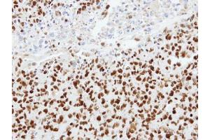 Immunohistochemistry (IHC) image for anti-Heterogeneous Nuclear Ribonucleoprotein K (HNRNPK) antibody (ABIN2855169)