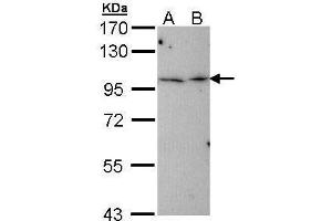 WB Image Sample (30 ug of whole cell lysate) A: Hep G2 , B: Molt-4 , 7. (TBCK antibody)