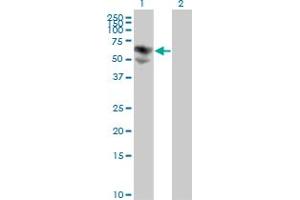 Western Blot analysis of BTD expression in transfected 293T cell line by BTD monoclonal antibody (M01), clone 3B10-2B3.