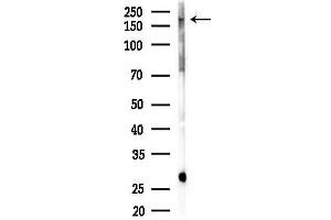 Western blot analysis of lysates from Mouse lung, using NRAP Antibody at 1/1000 dilution.