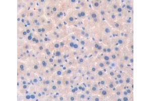 Used in DAB staining on fromalin fixed paraffin- embedded liver tissue (TSSK1 antibody  (AA 57-314))