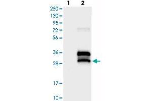 Western blot analysis of Lane 1: Negative control (vector only transfected HEK293T lysate), Lane 2: Over-expression Lysate (Co-expressed with a C-terminal myc-DDK tag (~3. (BRICD5 antibody)
