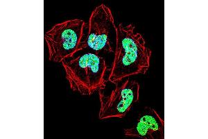 Fluorescent confocal image of Hela cell stained with ZN Antibody (C-term) (ABIN1537388 and ABIN2848620). (ZNF155 antibody  (C-Term))