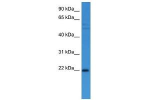 Western Blot showing GADD45A antibody used at a concentration of 1-2 ug/ml to detect its target protein. (GADD45A antibody  (C-Term))
