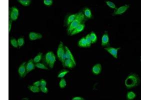Immunofluorescence staining of HepG2 cells with ABIN7152940 at 1:166, counter-stained with DAPI. (FIL1L antibody  (AA 1-200))