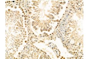 anti-Hect Domain and RLD 5 (HERC5) (Internal Region) antibody