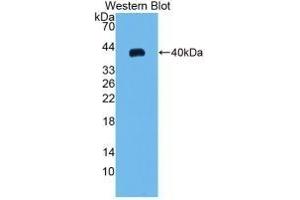 Detection of Recombinant MIP3a, Rat using Monoclonal Antibody to Macrophage Inflammatory Protein 3 Alpha (MIP3a) (CCL20 antibody  (AA 24-95))