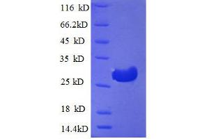 SDS-PAGE (SDS) image for Cathepsin F (CTSF) (AA 273-484), (partial) protein (His tag) (ABIN1046784) (Cathepsin F Protein (CTSF) (AA 273-484, partial) (His tag))