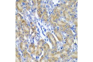 Immunohistochemistry of paraffin-embedded rat kidney using CRYAA antibody (ABIN5973354) at dilution of 1/200 (40x lens). (CRYAA antibody)