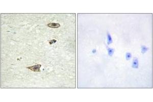 Immunohistochemistry analysis of paraffin-embedded human brain tissue, using GRK1 (Ab-21) Antibody. (GRK1 antibody  (AA 6-55))