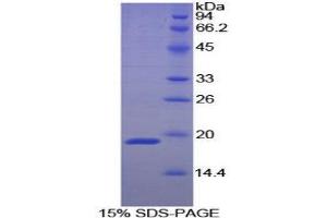 SDS-PAGE (SDS) image for Annexin A1 (ANXA1) (AA 224-336) protein (His tag,SUMO Tag) (ABIN1169884) (Annexin a1 Protein (AA 224-336) (His tag,SUMO Tag))