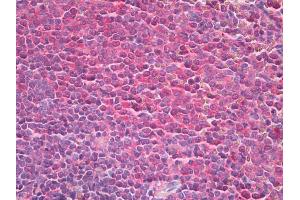 Human Spleen: Formalin-Fixed, Paraffin-Embedded (FFPE) (TPT1 antibody)