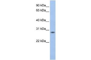Western Blotting (WB) image for anti-MPV17 Mitochondrial Membrane Protein-Like 2 (MPV17L2) antibody (ABIN2459191) (MPV17L2 antibody)