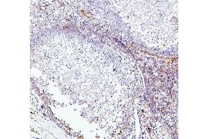 IHC analysis of TEK using anti-TEK antibody (ABIN7600762). (TEK antibody  (AA 23-616))