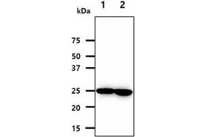 The cell lysates (40ug) were resolved by SDS-PAGE, transferred to PVDF membrane and probed with anti-human NNMT antibody (1:1000). (NNMT antibody)
