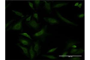 Immunofluorescence of monoclonal antibody to ATP2A1 on HeLa cell. (ATP2A1/SERCA1 antibody  (AA 522-612))