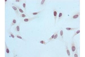 Immunocytochemistry (ICC) image for anti-Histone Cluster 1, H3a (HIST1H3A) (H3R2me) antibody (ABIN7127304)