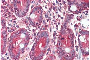 Anti-GLP2R antibody  ABIN1048669 IHC staining of human small intestine. (GLP2R antibody  (C-Term))