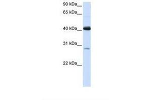 Image no. 1 for anti-Glutaryl-CoA Dehydrogenase (GCDH) (AA 146-195) antibody (ABIN6738082) (GCDH antibody  (AA 146-195))