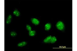Immunofluorescence of purified MaxPab antibody to PRDM15 on HeLa cell.