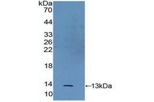 Western blot analysis of recombinant Human S100A2. (S100A2 antibody  (AA 2-98))