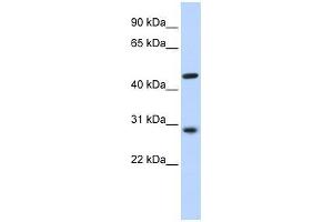 PYGO2 antibody used at 0. (PYGO2 antibody  (N-Term))