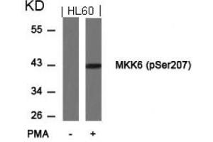 Image no. 3 for anti-Mitogen-Activated Protein Kinase Kinase 6 (MAP2K6) (pSer207) antibody (ABIN196865) (MAP2K6 antibody  (pSer207))