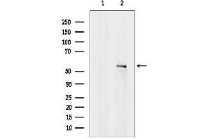 anti-Cholinergic Receptor, Muscarinic 4 (CHRM4) (Internal Region) antibody