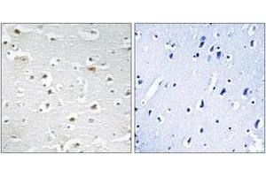 Immunohistochemistry analysis of paraffin-embedded human brain tissue, using DDX3Y Antibody.