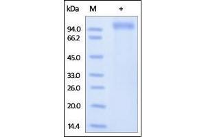 Human LRRC4, His Tag on SDS-PAGE under reducing (R) condition. (LRRC4 Protein (AA 39-527) (His tag))