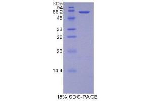 SDS-PAGE (SDS) image for Arginase, Type II (ARG2) (AA 23-354) protein (His tag) (ABIN1878488) (ARG2 Protein (AA 23-354) (His tag))