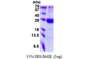 Figure annotation denotes ug of protein loaded and % gel used. (MED20 Protein)