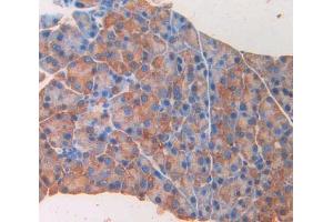 IHC-P analysis of pancreas tissue, with DAB staining. (GAD antibody  (AA 1-97))