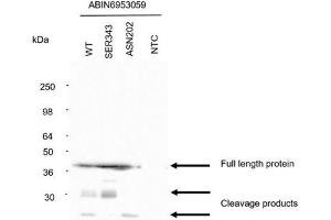 Detection of N protein.