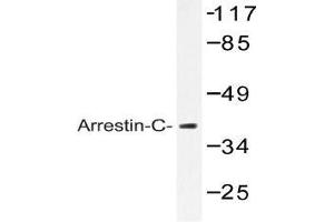 Western blot (WB) analysis of Arrestin-C antibody in extracts from LOVO cells. (ARR3 antibody)