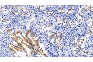 Detection of KRT6A in Human Small intestine Tissue using Monoclonal Antibody to Keratin 6A (KRT6A) (KRT6A antibody  (AA 163-468))