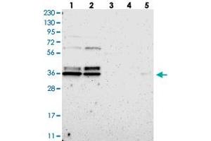 Western blot analysis of Lane 1: RT-4, Lane 2: U-251 MG, Lane 3: Human Plasma, Lane 4: Liver, Lane 5: Tonsil with TMBIM1 polyclonal antibody . (TMBIM1 antibody)