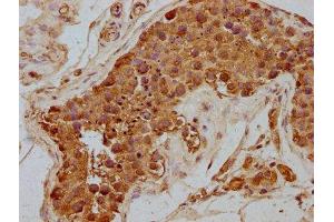 IHC image of ABIN7168473 diluted at 1:300 and staining in paraffin-embedded human testis tissue performed on a Leica BondTM system. (Rubicon antibody  (AA 518-733))