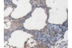 IHC-P analysis of Pig Lung Tissue, with DAB staining.