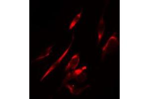 ABIN6274289 staining HeLa cells by IF/ICC. (MAPK10 antibody  (C-Term))