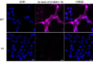 Immunocytochemical staining of Hela cells using Annexin A1 antibody (ABIN7797614), 1:1,000), Top panel: wild-type (WT), Bottom panal: Annexin A1 shRNA knockdown (KD).